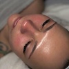 Image 2: Revitalize Your Skin with upto Three 90-minute Hydrafacials Sessions