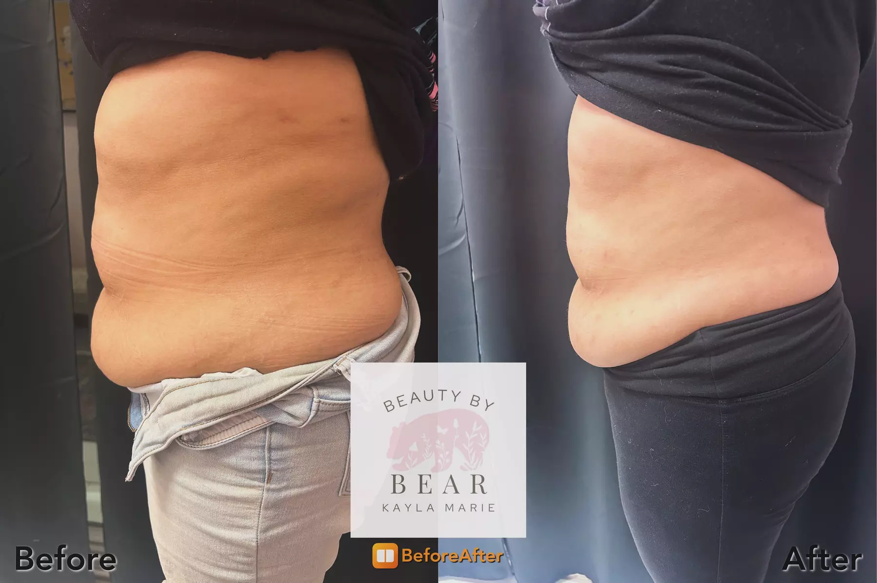 semaglutide elk grove ca Health & Fitness Weight Loss in Elk Grove - Deals Up to 70% Off