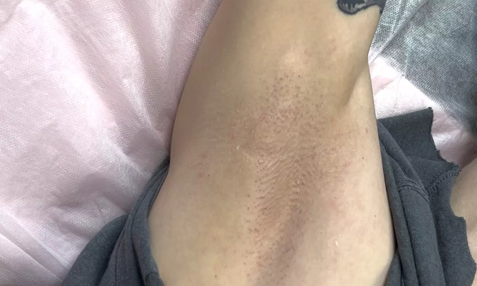 Expert Waxing & Targeted Hair Removal in a Professional Suite