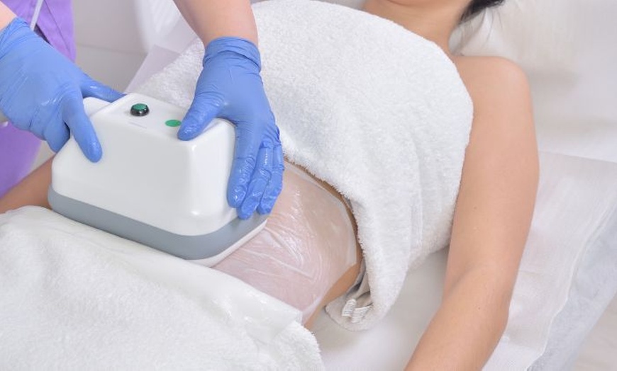 Image 1: One or Three Sessions of Cryolipolysis (One or Two Cups) 