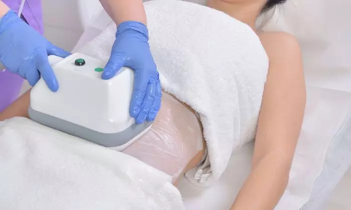 One or Three Sessions of Cryolipolysis (One or Two Cups) at London Body Centre