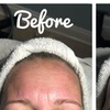 Image 3: One, Two, or Three HydraFacial Sessions for Glowing Skin