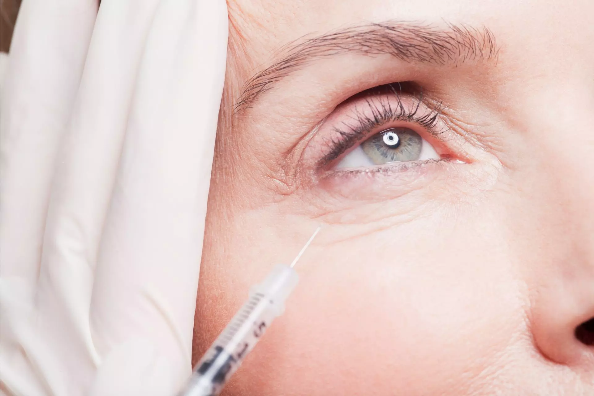Up to 53% Off on Injection - Dermal Filler at UK Aesthetics Lounge