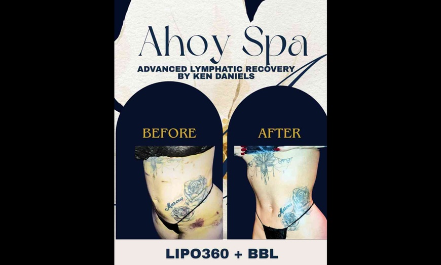 Image 3: Tummy Tuck, Lipo 360 & BBL Post-Op Recovery Consult Massage