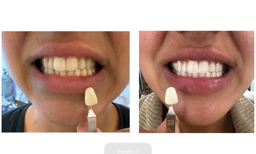 Image 2: Bis zu 46% Rabatt auf den  bei Esthétique de paris