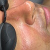 Image 1: Luxury Exosome Mesotherapy with PDRN for Skin Repair & Radiance