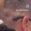 Image 2: Up to 37% Off on Tattoo Removal at My Laser and Beauty