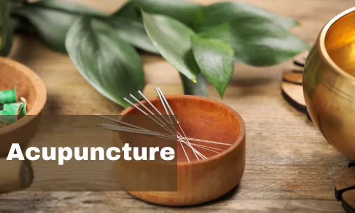 Unlock Holistic Wellness Through Acupuncture Course at Training Station (Up to 58% Off) - Primary Image