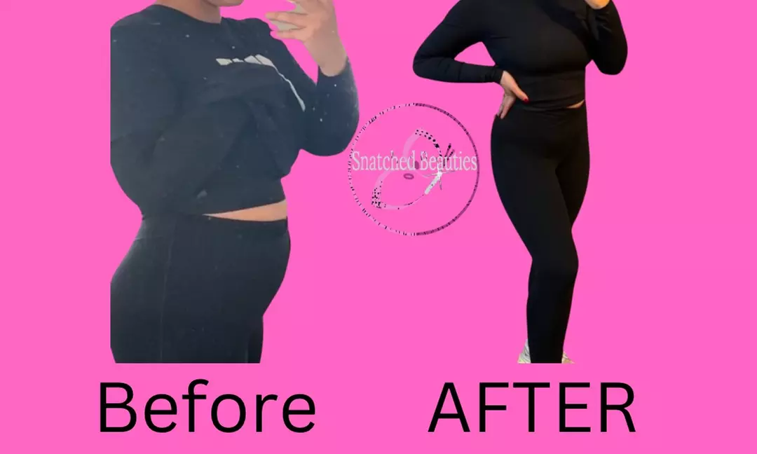 Liquid Lipo for You: Full Stomach or Target Areas (Bra, Back, Arms) for Up to 50% Off at Snatched Beauties - Primary Image