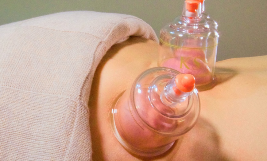 Image 3: 90-Minute Initial Acupuncture or Acupuncture & Cupping Session