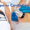 Image 3: Up to 65% Off on Lipo - Non-Invasive Laser-iLipo at Coco Luxe Beauty