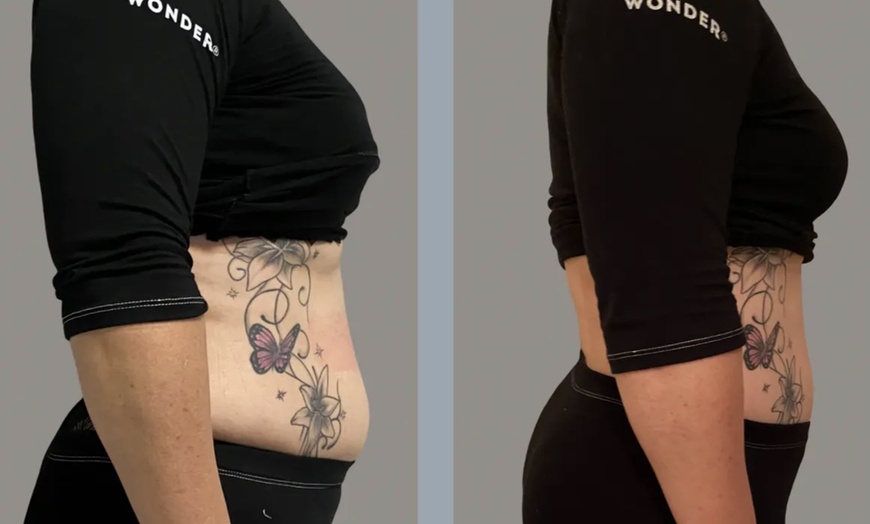 Image 7: Experience Muscle Building and Fat Reduction with Wonder Sessions