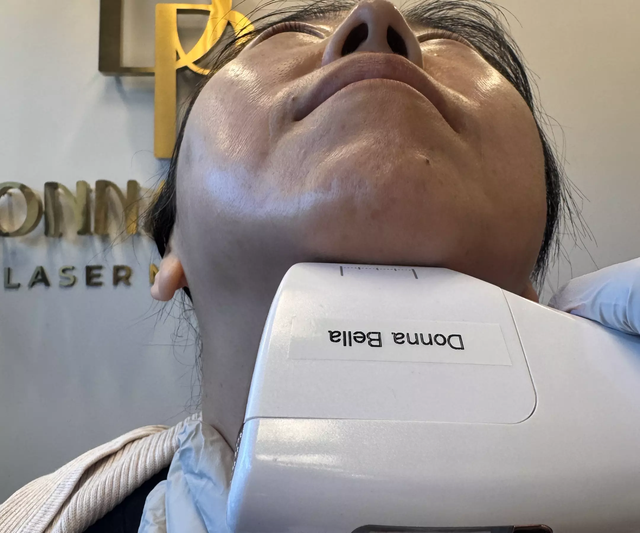 HIFU Non-Invasive Lifting, Skin Tightening of Skin, Jawline and Cheeks