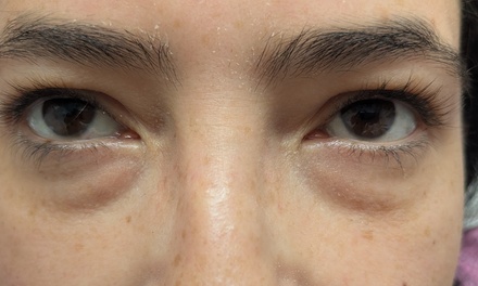 One PRF Natural Under-Eye Dark Circle and Puffiness Treatment - New life Cosmetic llc