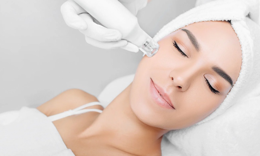 Image 1: One or Three Sessions of Skin or EMS Micro-Needling For Face or Neck