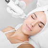 Image 1: One or Three Sessions of Skin or EMS Micro-Needling For Face or Neck