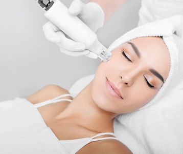 One session of Skin Needling - Facial - Organik Laser & Beauty