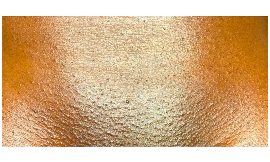 Image 6: Up to 57% Off on Brazilian / Bikini Waxing