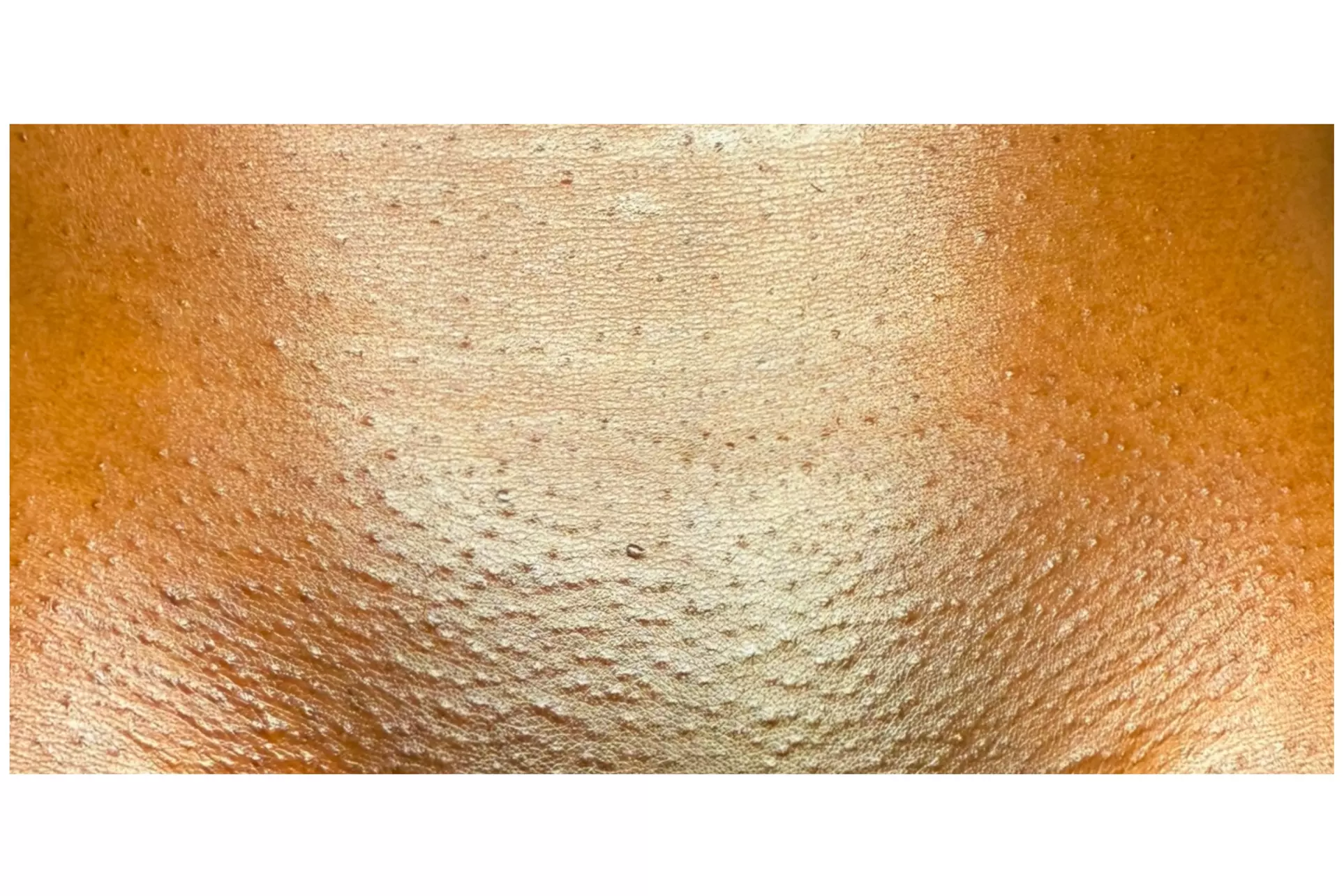 Up to 61% Off on Brazilian / Bikini Waxing