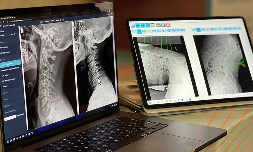 Image 6: Up to 91% Off on Chiropractic Services at Aligned Health Center