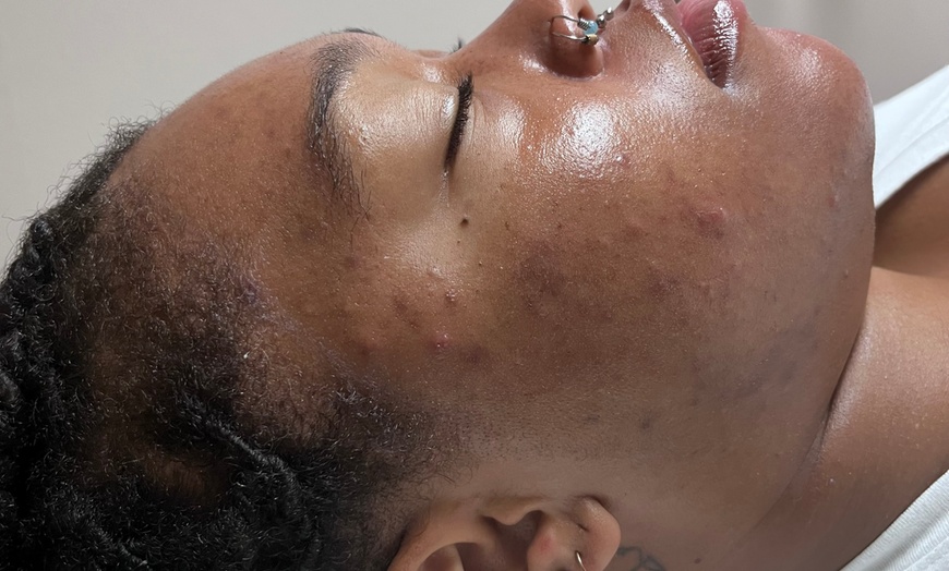 Image 2: Refreshing Glow or Custom Facial for Radiant Skin