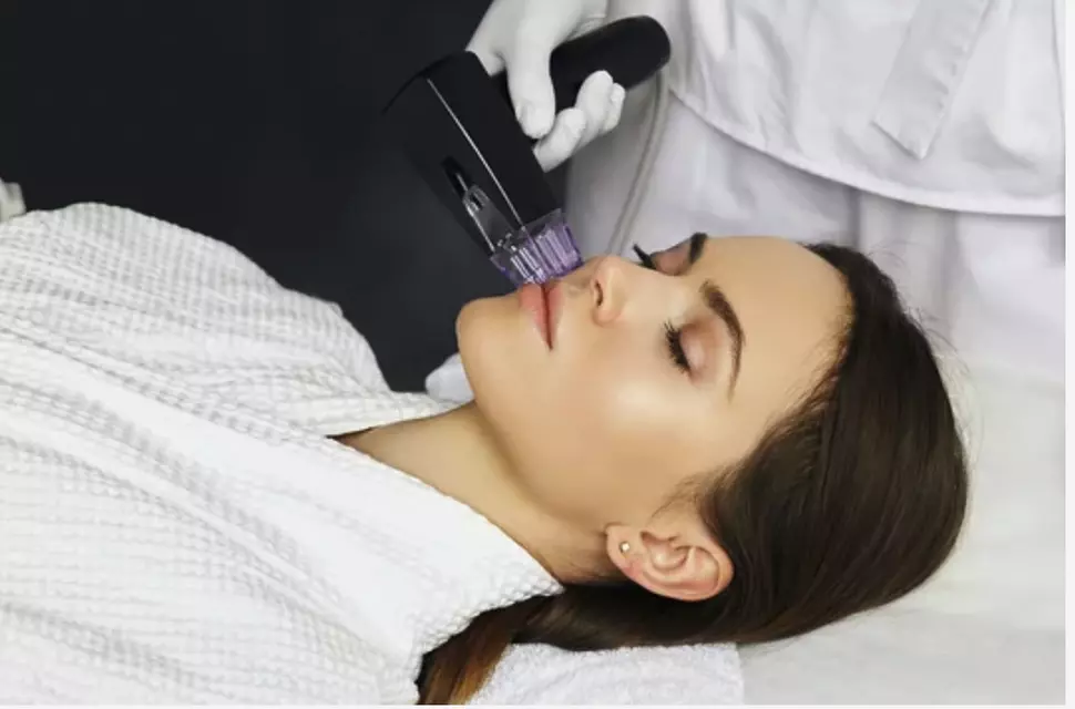 Single or Two Morpheus8 Sessions - Full Face & Neck