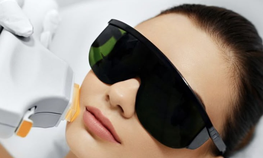 Image 5: IPL, Carbon Laser, RF Lifting or Micro-needling Facial Sessions
