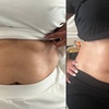 Image 1: Up to 57% Off on Cavitation at Skin laboratory