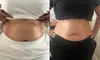 Up to 52% Off on Cavitation at Skin laboratory