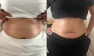 tirzepatide weight loss jackonsville TOP 10 BEST in Jacksonville, FL - Updated 2026 - Quality & Affordability Tirzepatide Injections for Medical Weight