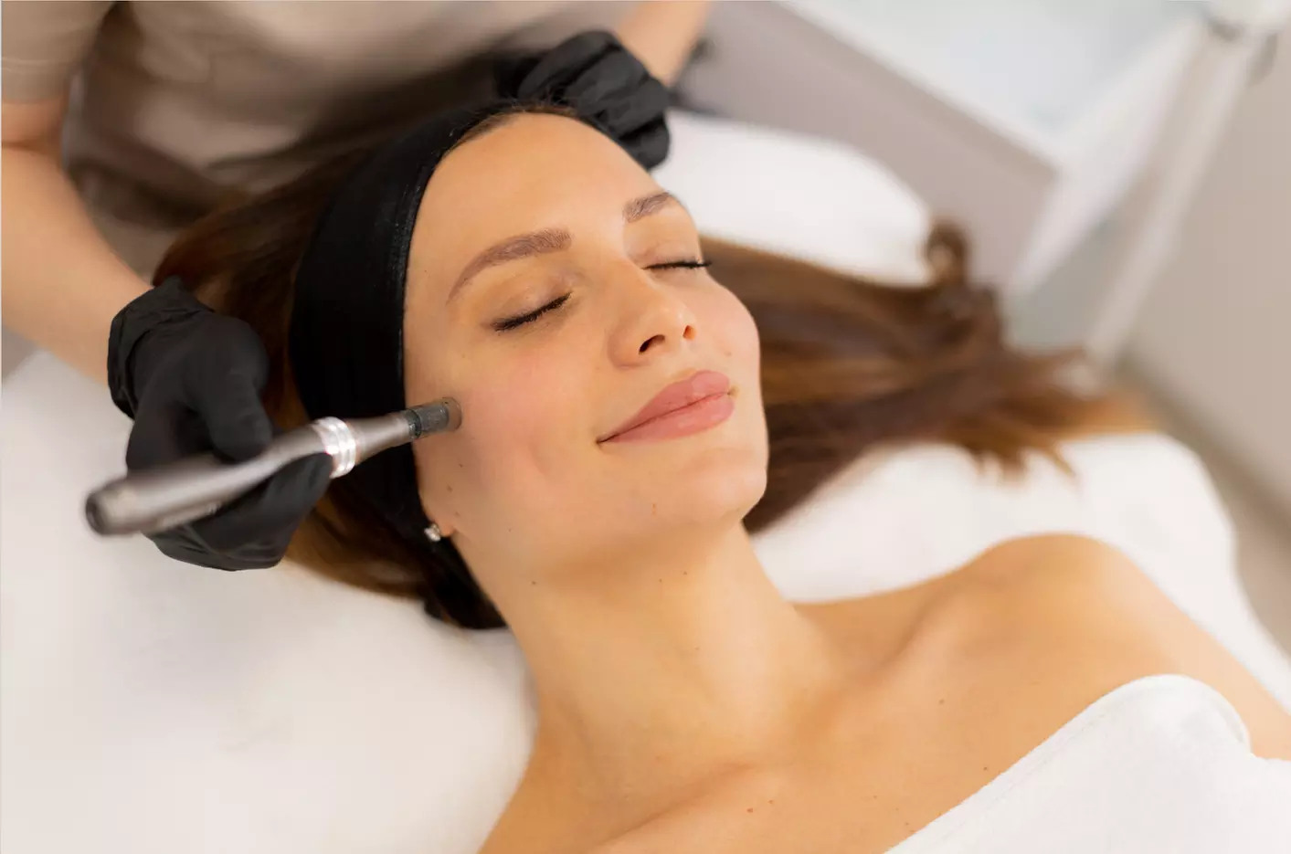 Revitalize Your Skin with Microneedling Sessions