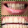 Image 4: Brighten Your Smile With Teeth Whitening, Polishing & More 