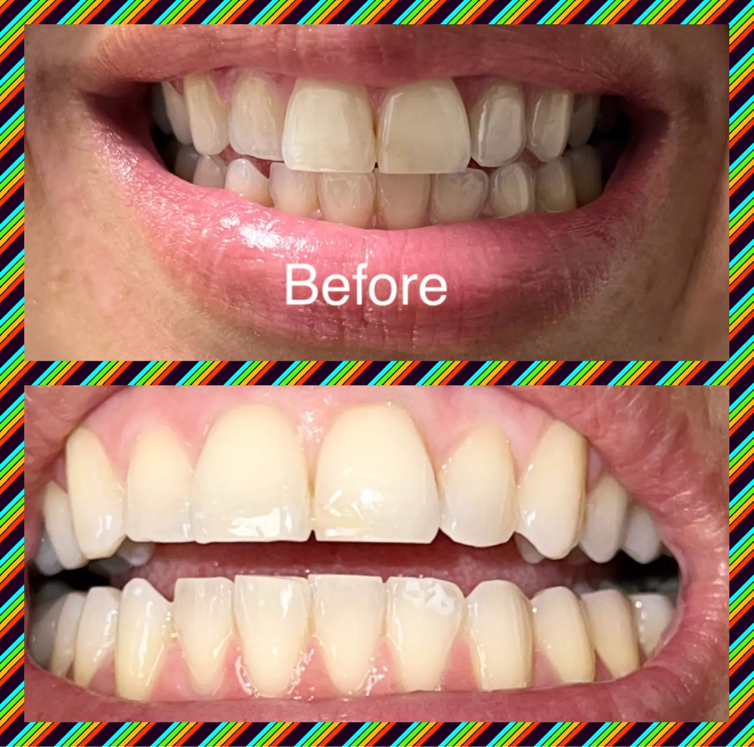 Brighten Your Smile With Teeth Whitening, Polishing & More
