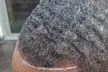 One or Two Scalp Micro-pigmentation Hair Loss Treatment
 Up to 37% Off - Second Medium