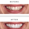Image 3: Teeth Whitening Full Service Treatment 60-minute and More