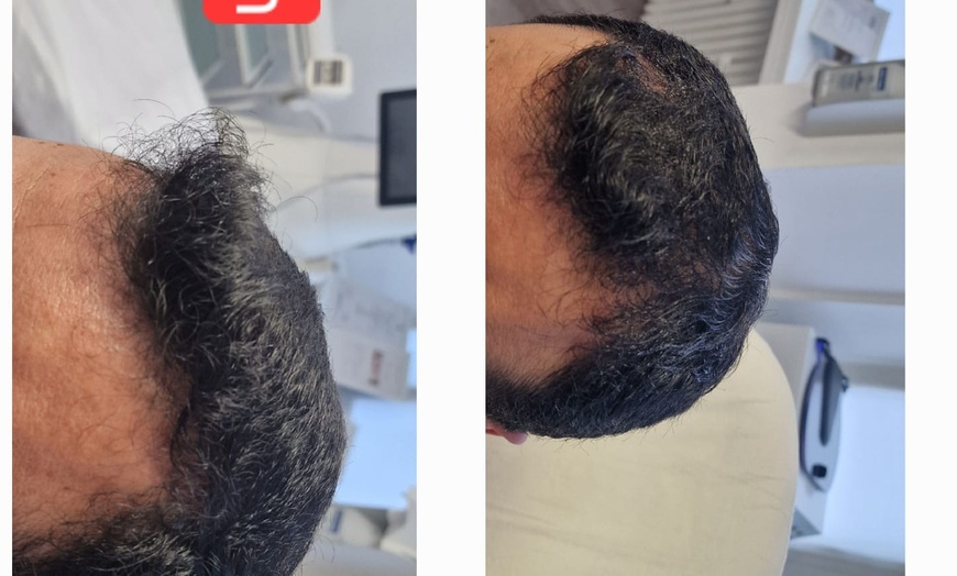 Image 5: Bis zu 10% Rabatt auf den Facial - Eigenblut bei PRIVATPRAXIS Nataliya Katsarova