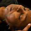 Image 1: Up to 43% Off on Acupuncture at The Golden Life Acupuncture