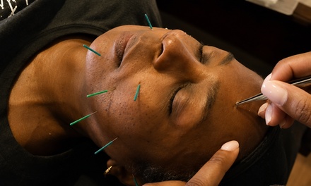 One Cosmetic Acupuncture Facial Rejuvenation Treatment with LED - The Golden Life Acupuncture