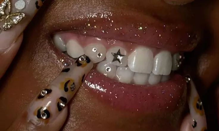 Get a Sparkling Smile with Single, Two or Three Tooth Gems at Ebony Star Stylez ( Up to 20% Off ) - Primary Image