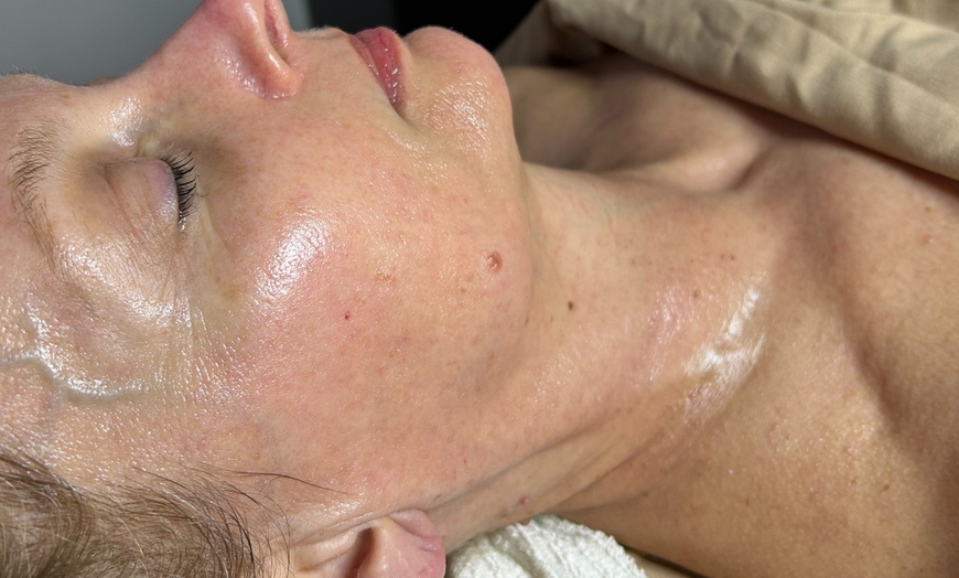 Image 3: Up to 42% Off on Facial at Kylie Anne Esthetics