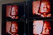 Up to 32% Off on Ultrasound - 3D / 4D at Imaging With Love 3D/4D/5D & 8K Pregnancy Ultrasounds in Miami – At Home & In Office - Second Medium