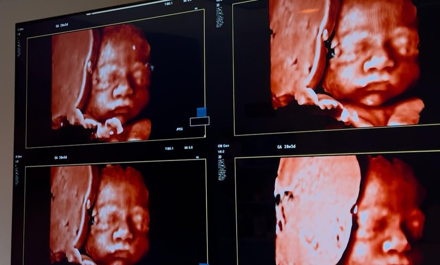 Image 2: Up to 32% Off on Ultrasound - 3D / 4D at Imaging With Love 3D/4D/5D & 8K Pregnancy Ultrasounds in Miami – At Home & In Office