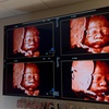 Image 2: Up to 39% Off on Ultrasound - 3D / 4D at Imaging With Love 3D/4D/5D & 8K Pregnancy Ultrasounds in Miami – At Home & In Office