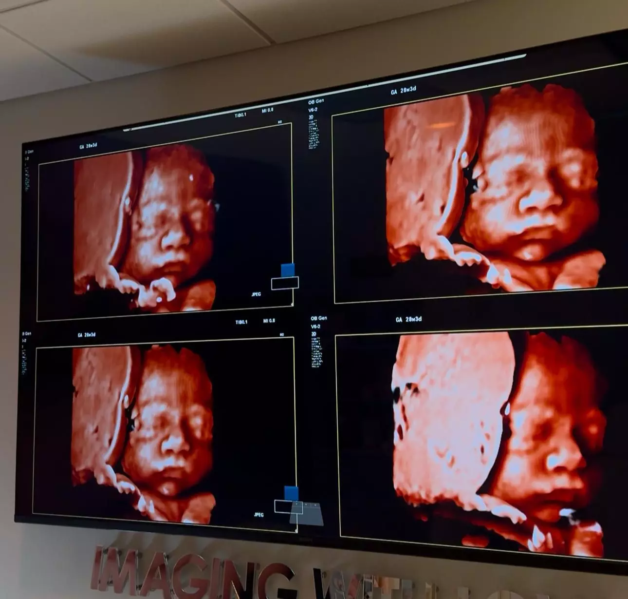 See Baby in Real-Time with 45-Minute 2D/3D/4D/5D Ultrasound