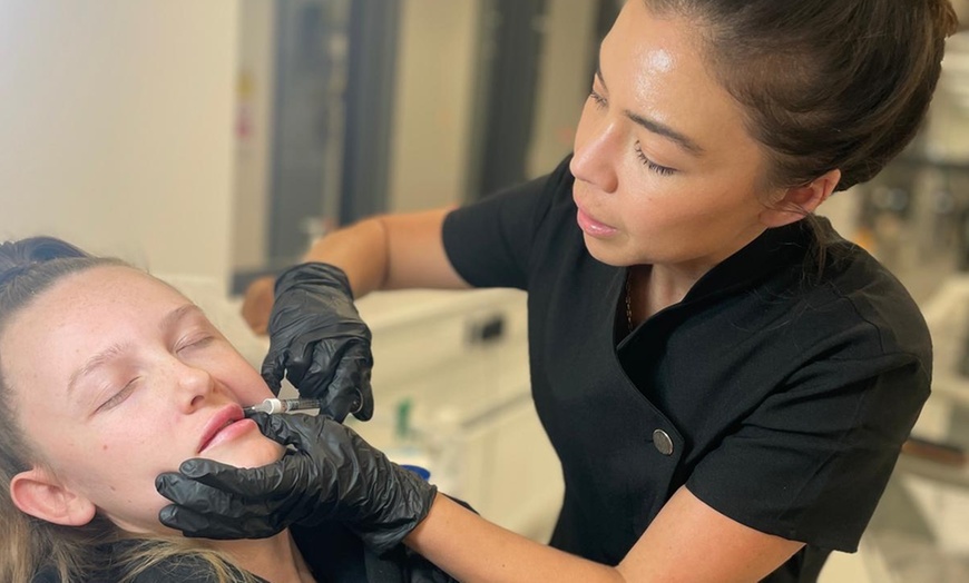 Image 1: Transform Your Look with 0.55ml or 1ml: Russian Lip Filler