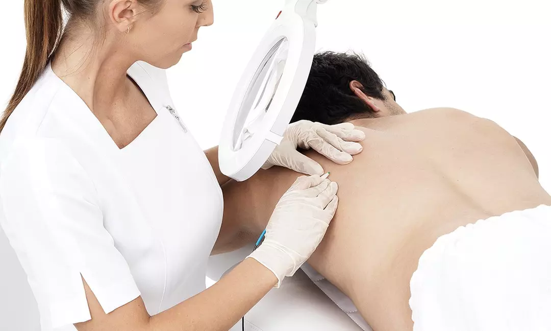 One, Six, or Ten 30 or 60-Minute Electrolysis Sessions