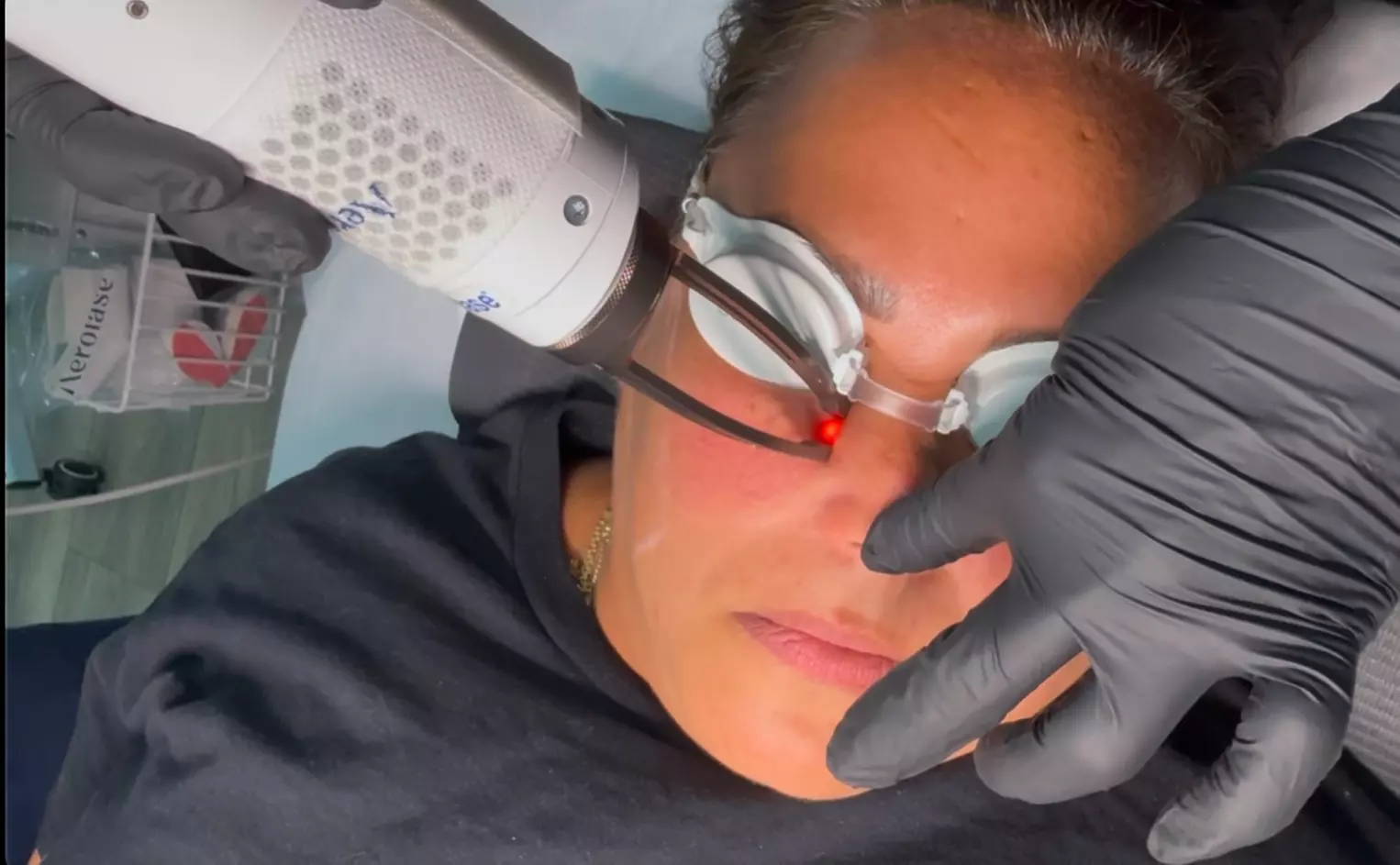 Up to 80% Off on Laser Hair Removal at Issa Selflove Oasis - Primary Image