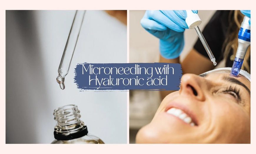 Image 1: Refresh your skin w/ 1 or 3 Micro-Needling Hyaluronic Acid Treatment 