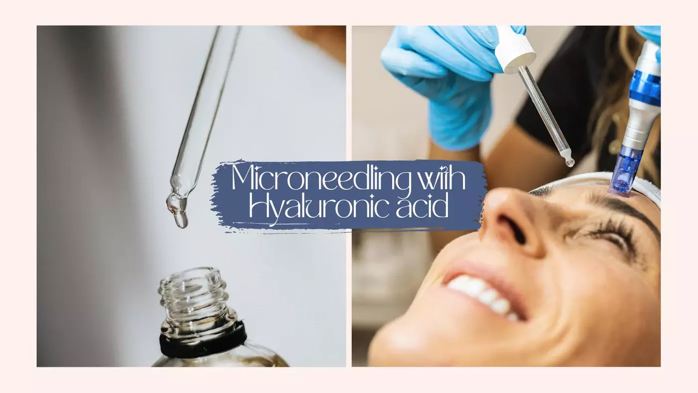 Refresh your skin with 1 or 3 Micro-Needling Hyaluronic Acid Treatment at VVS Permanent Beauty - Up to 50% Off - Primary Image