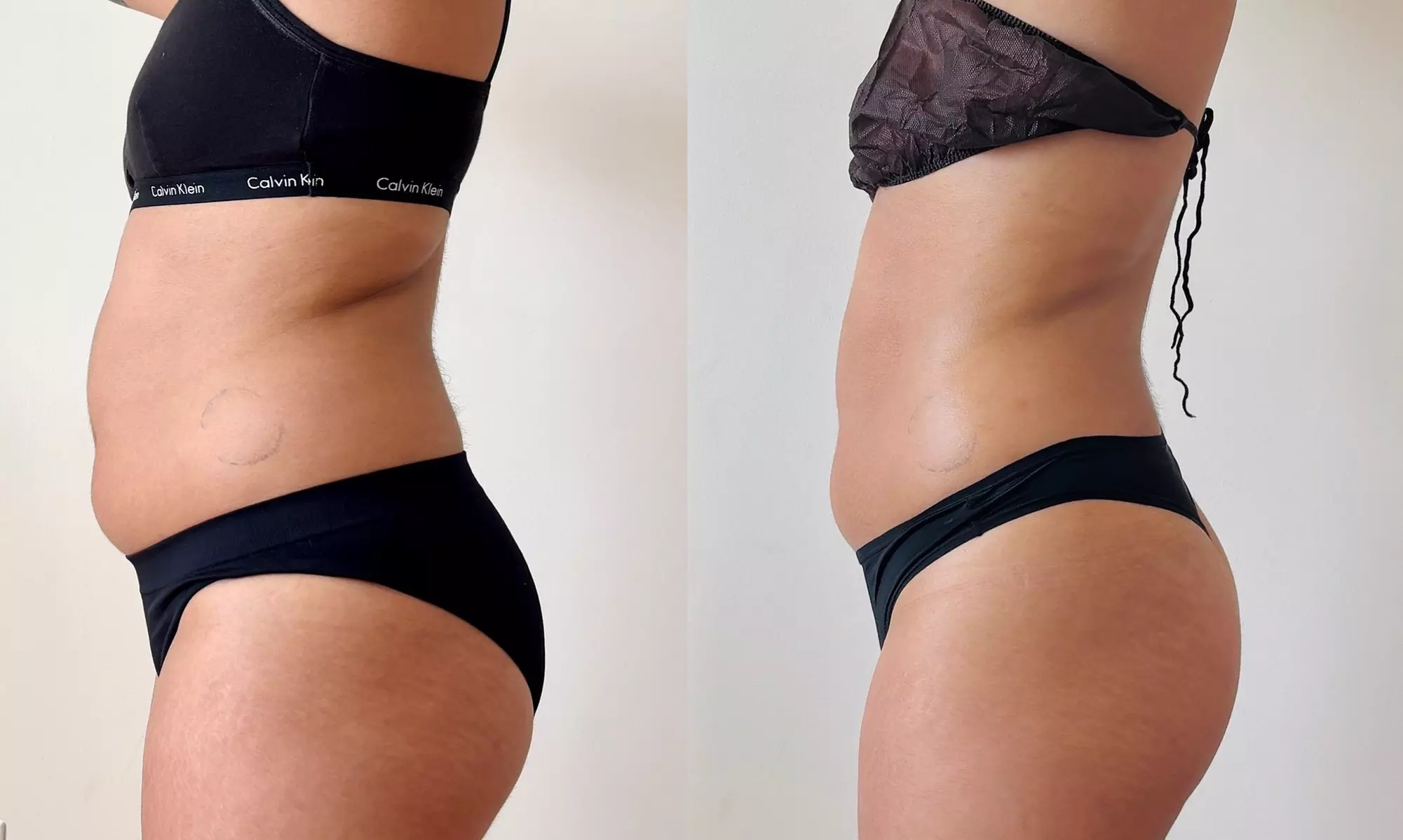 1 or 3 Deluxe Body Sculpting Sessions or 4 Vacuum Therapy Butt Enhancement Treatments (Up to 50% Off) - Primary Image